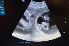 Štěňata, ultrazvuk